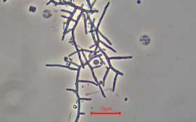 Bug of the Month: Learn About the Actinomycetes-Mycolata Filament Morphotype