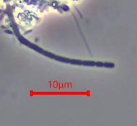 Bug of the Month: Learn About Type 1701 Filaments and Sludge Bulking